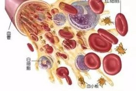 中性粒细胞低到什么程度是白血病 应该怎样