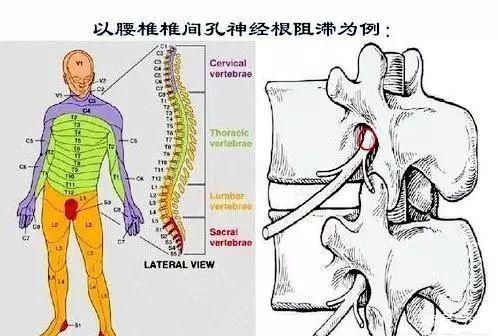 腰压迫神经腿疼一般多久能恢复了 忽视治疗麻烦很大