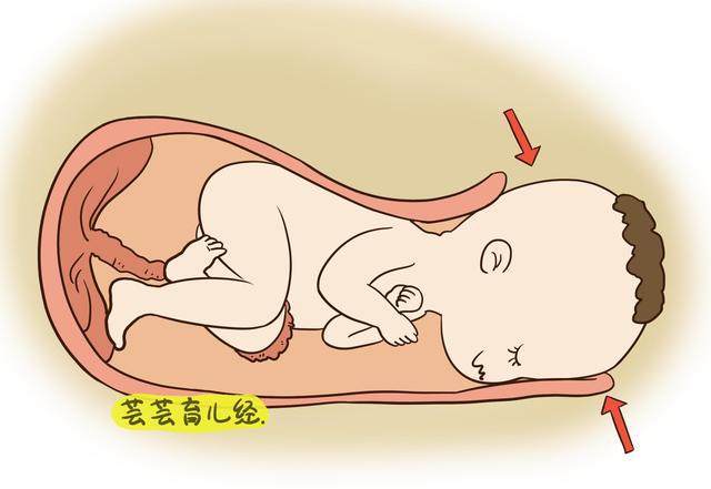 婴儿偏头最好的纠正法图解 婴儿同一个姿势睡觉不要太长时间