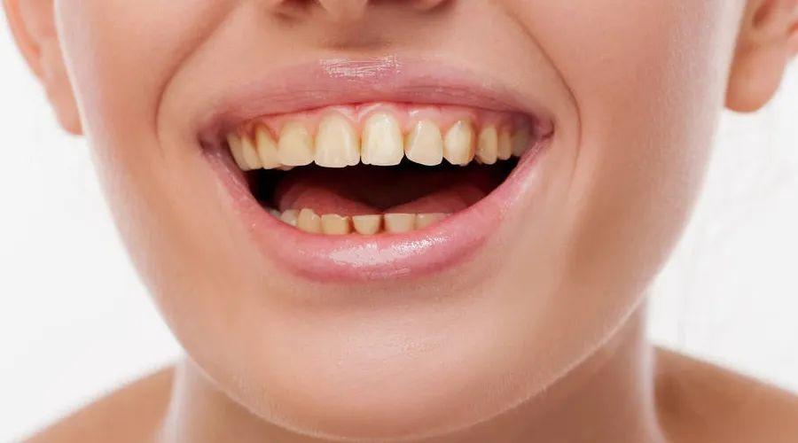 牙膏上放盐刷牙真的美白吗 张开嘴就能看到一口洁白的牙齿